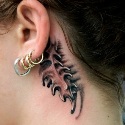 tattoo removal in Gurgaon