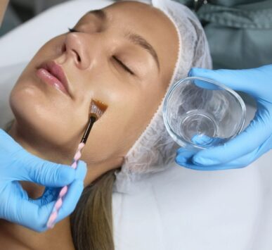 chemical peels gurgaon