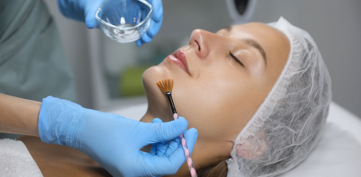 chemical peels Gurgaon