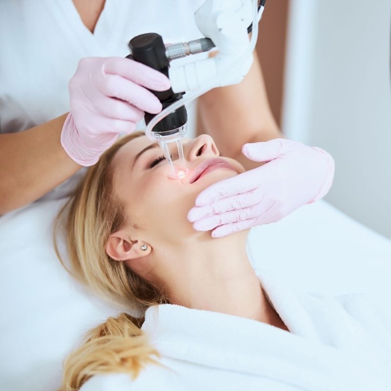 wrinkle laser removal