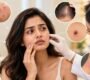 Dermatologist 1 90x80