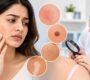 Skin Specialist in Gurgaon 1 90x80