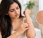 Skin Specialist in Gurgaon 90x80